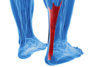 Achilles tendonitis treatment in the Evanston, IL 60202 area