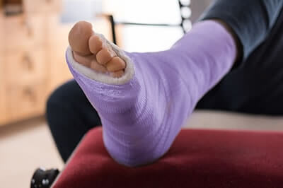Broken Foot and Ankle Treatment