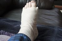 Foot Stress Fractures